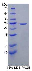 SDS-PAGE (GFAP-885H).jpg
